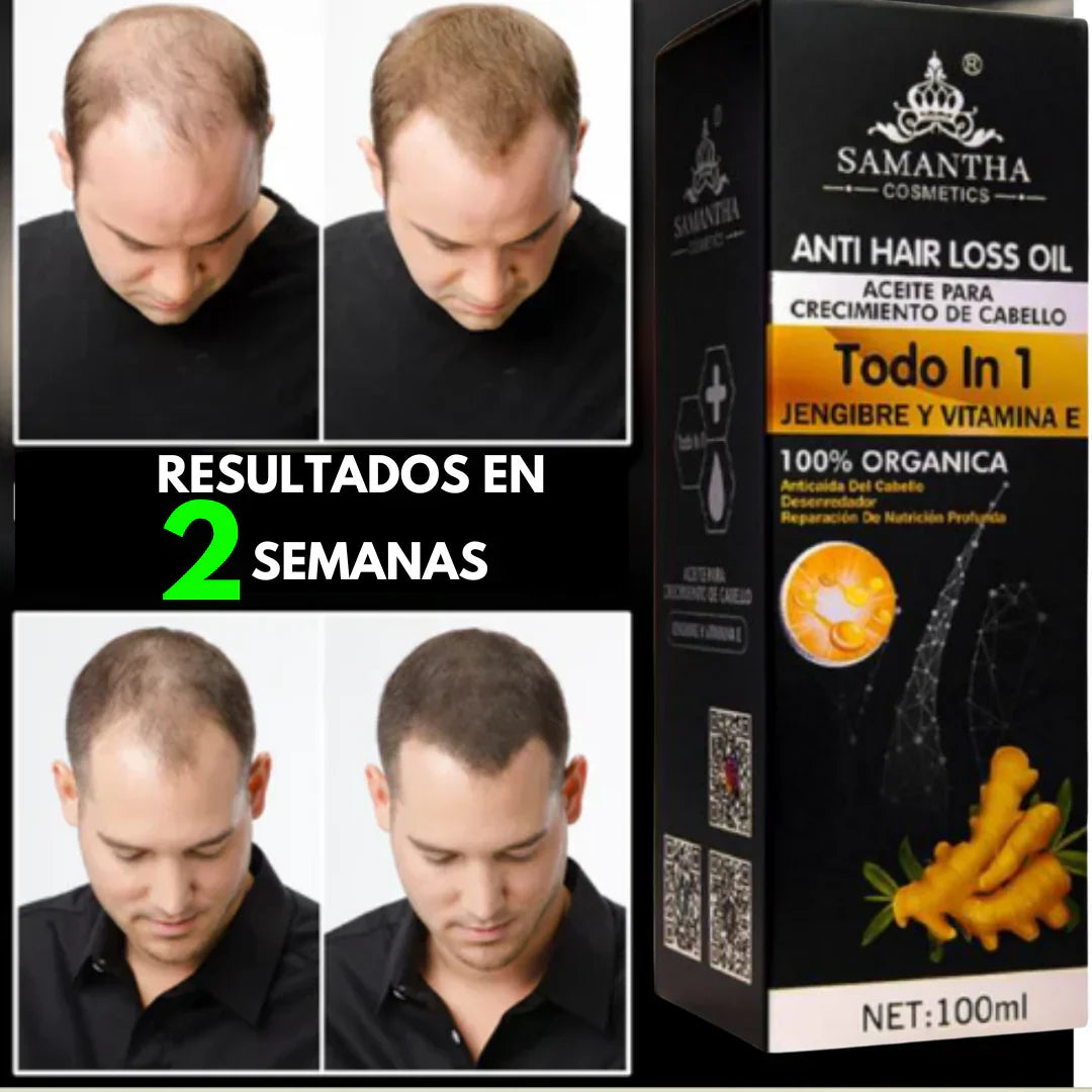 ACEITE ANTI PÉRDIDA DE CABELLO CON JENGIBRE Y VITAMINA E - TRATAMIENTO NUTRITIVO Y FORTALECEDOR - IDEAL PARA CABELLO SECO Y DAÑADO - 100ML